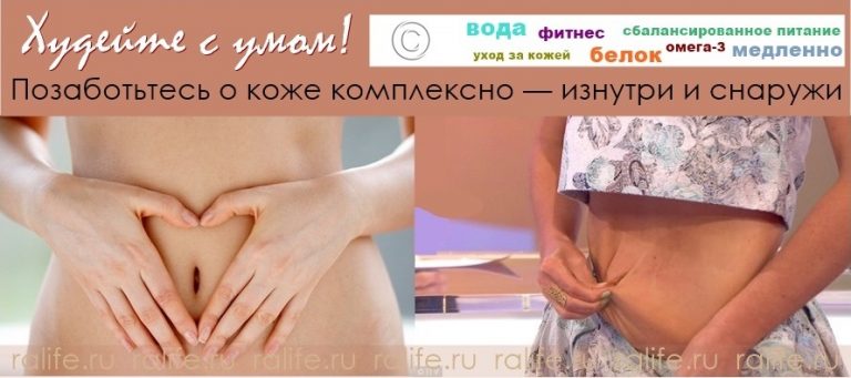 Обвисшая кожа на ногах как вы избавлялись Обвисшая кожа на ногах как вы избавлялись
