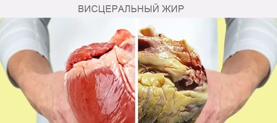 Почему растет живот