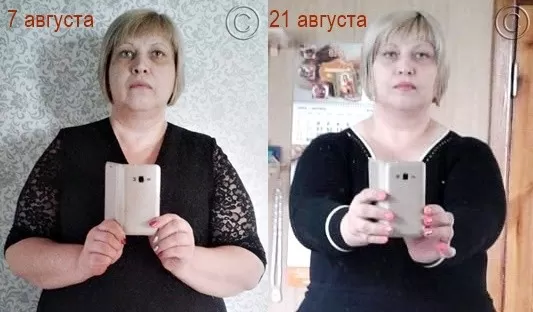 фото с результатом до и после