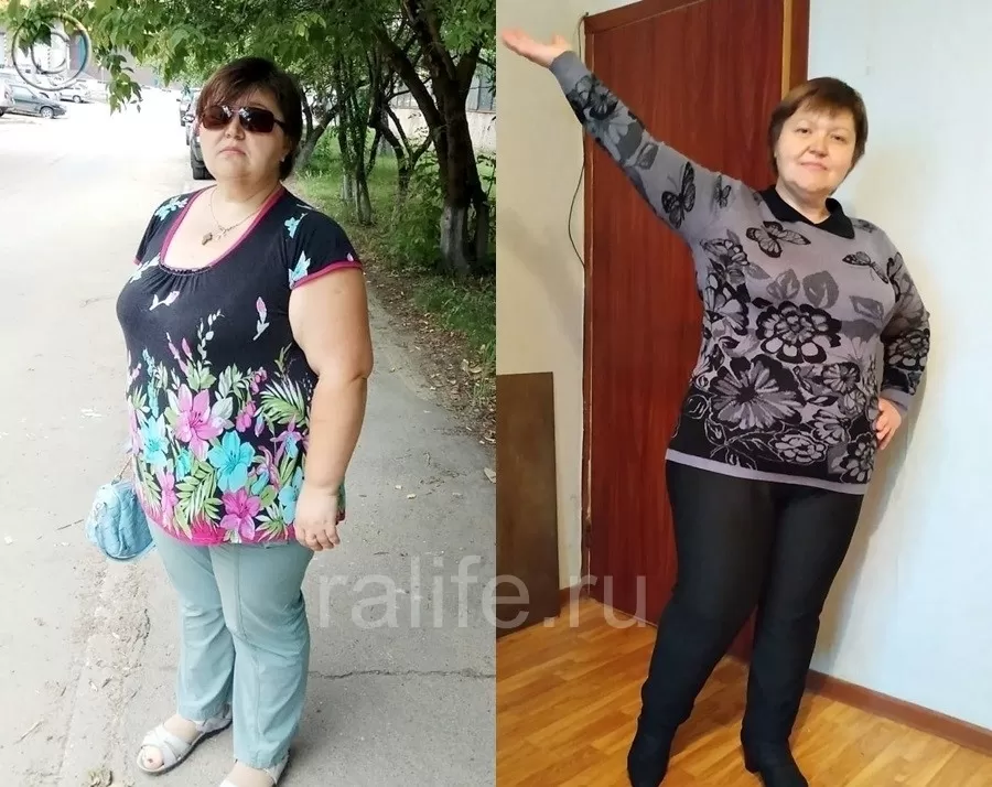 Вес уходит постепенно, и кожа успевает подтянуться