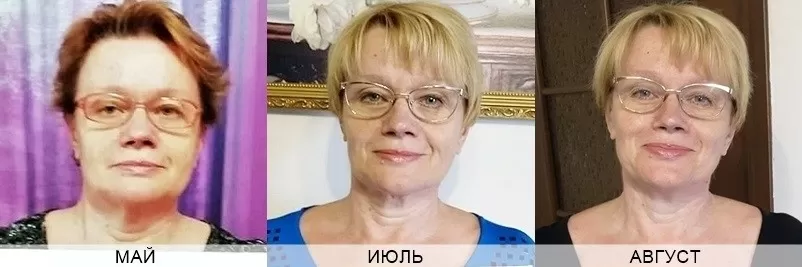 как помолодеть